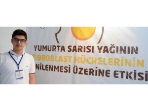 Erzurumlu Öğrencinin Başarılı Projesi