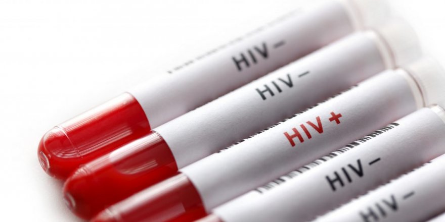 Kars’ta ‘HIV Virüsü’ne Rastlandı