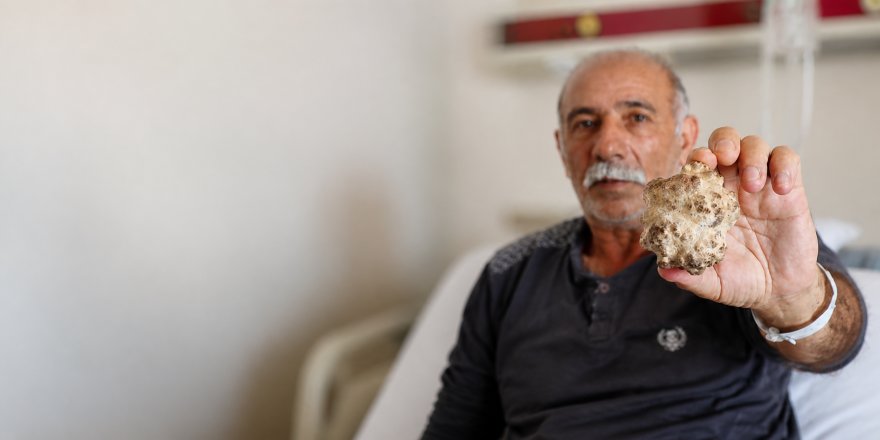 Kars’ta Şaşırtan Ameliyat.. Mesaneden 8 Santimlik Dev Taş Çıkarıldı!