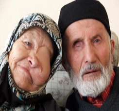Ardahanlı Yaşlı Çiftin KÖRLÜK Dramı