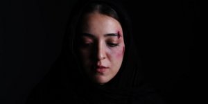 Şarkıcı Neco'dan Eşine Şiddet