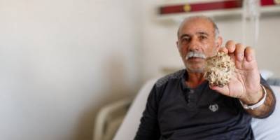 Kars’ta Şaşırtan Ameliyat.. Mesaneden 8 Santimlik Dev Taş Çıkarıldı!