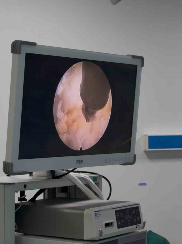 Adü Hastanesi’nde İlk Kez Uygulanmaya Başladı