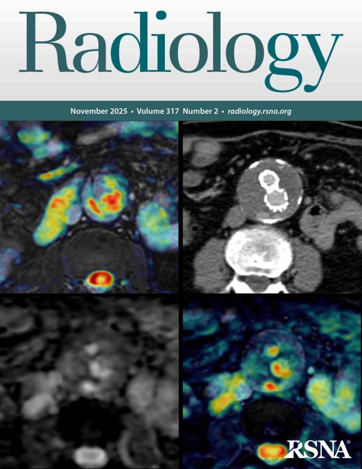 Tekden’de Başarılı Çalışmalara İmza Atan Radyoloji Uzmanından Hayati Tespit