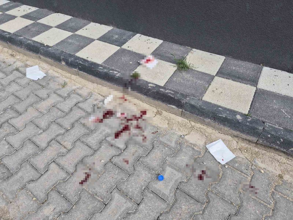 16 Yaşındaki Çocuk Caddede Bacağından Bıçaklandı
