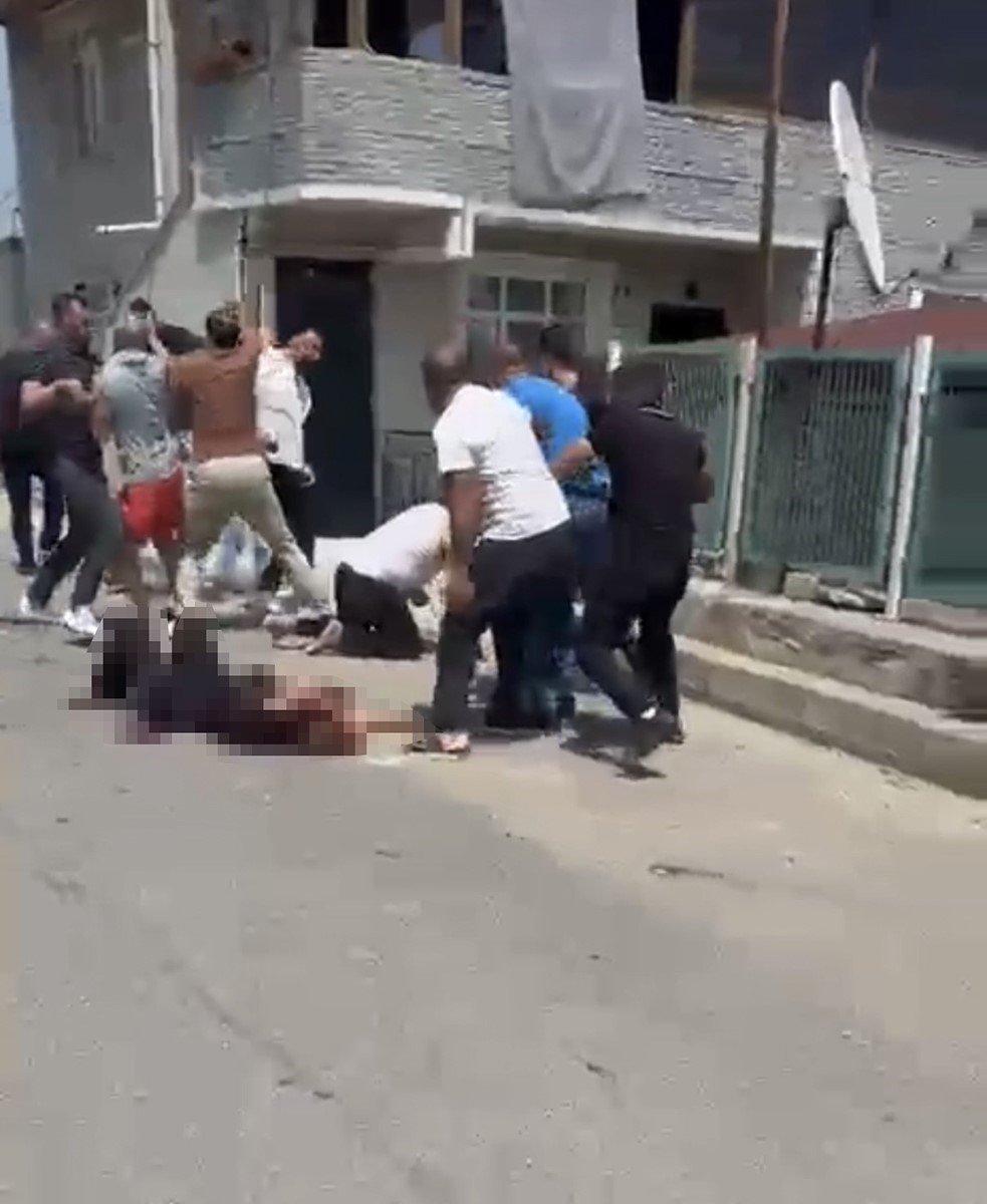 Erkek Şiddeti Kocaeli’de Bir Kadını Daha Hedef Aldı.. 5 Çocuk Annesi Ağır Yaralandı!