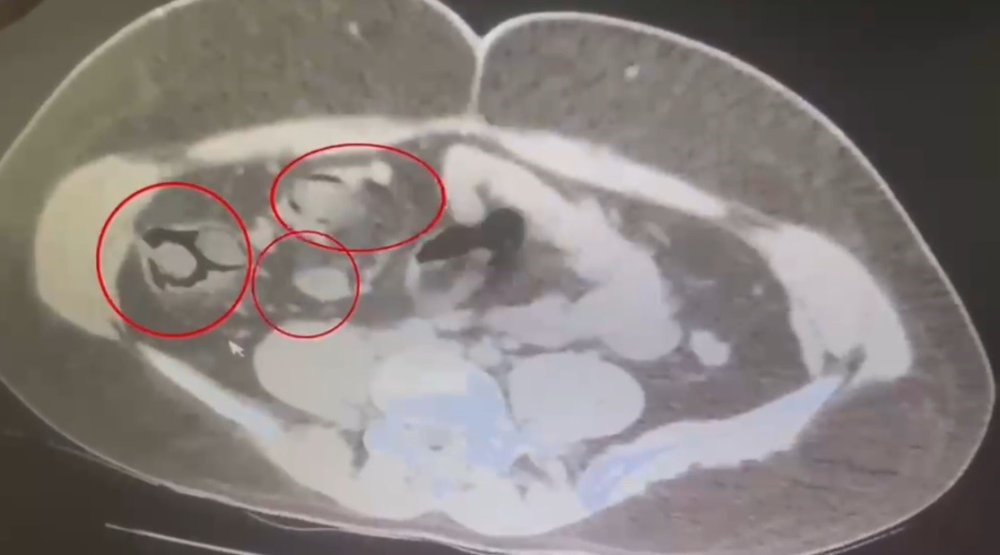 Kars'ta Narkotik Operasyonu.. İran Uyruklu Kurye 572 Gram Metamfetaminle Yakalandı!