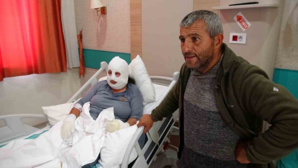 Ardahan Damal’da Yangın Faciası.. Kızını Kurtaran Anne Alevlerde Yaralandı!